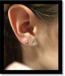 ears allergic to metalCheap Sell - OFF67