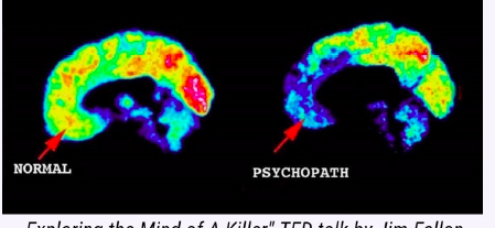 Psychopaths vs. Sociopaths | SciJourner